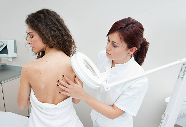 mole treatment Costa Mesa CA